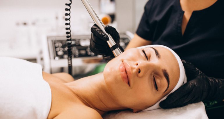 Microneedling