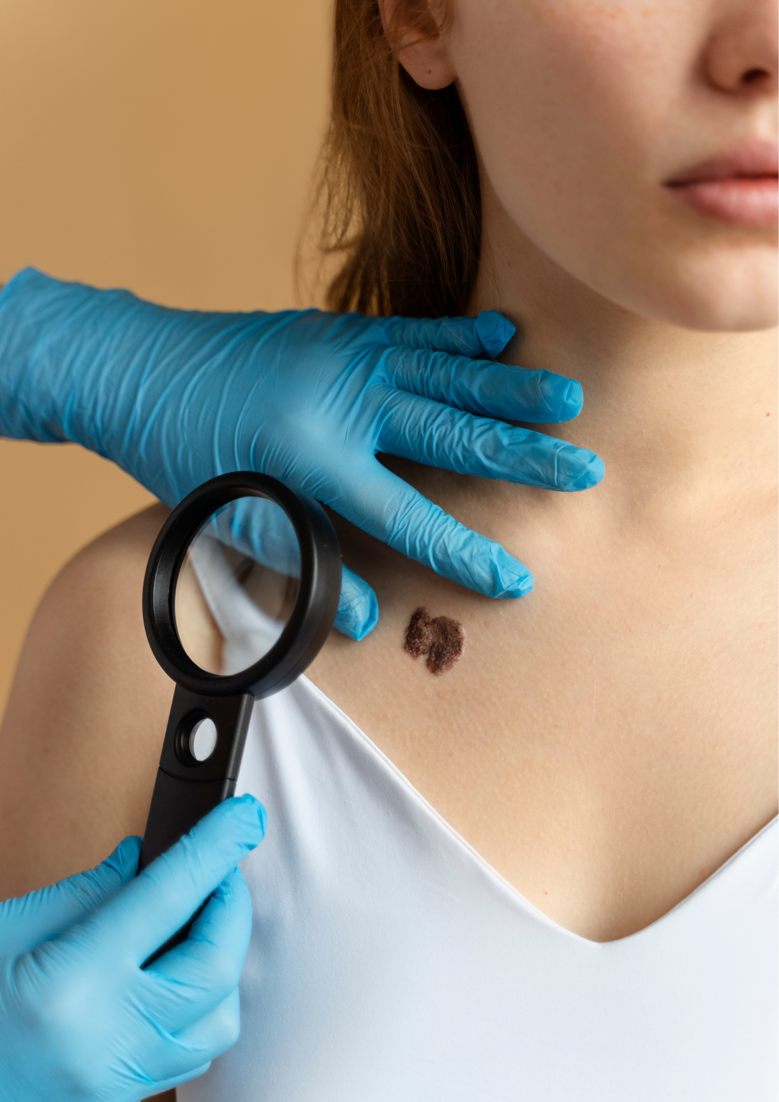 How to Remove Skin Tags Safely, According to Dermatologists