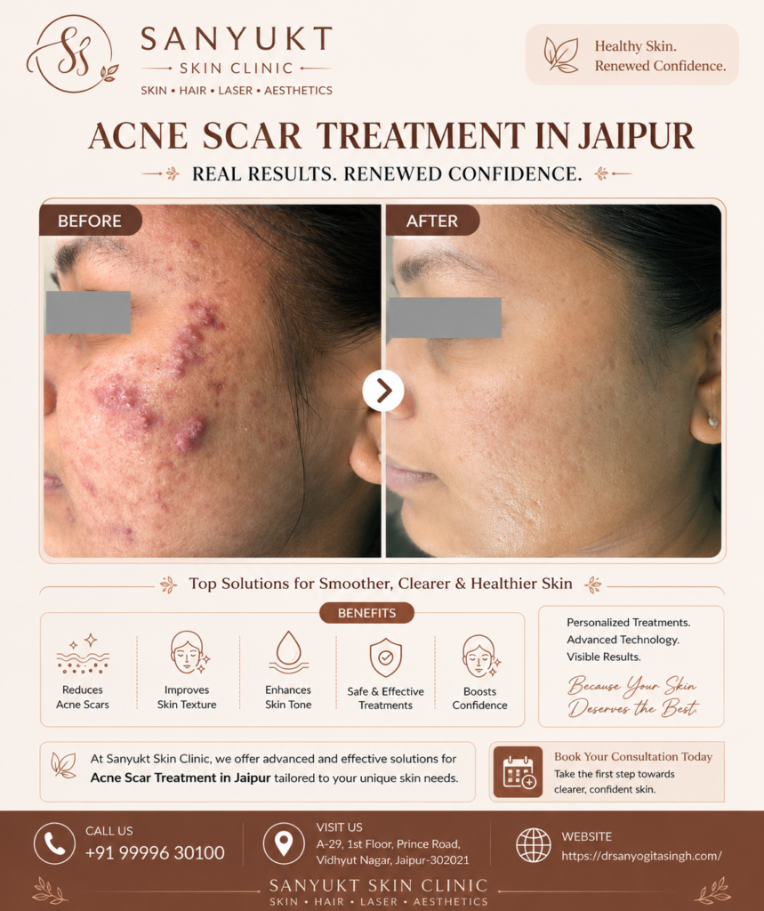 Acne Scar Treatment in Jaipur